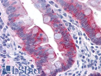 PathPlus™ GPR31 Antibody (Extracellular Domain)