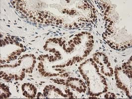 LOX / Lysyl Oxidase Antibody (clone OTI9G2)