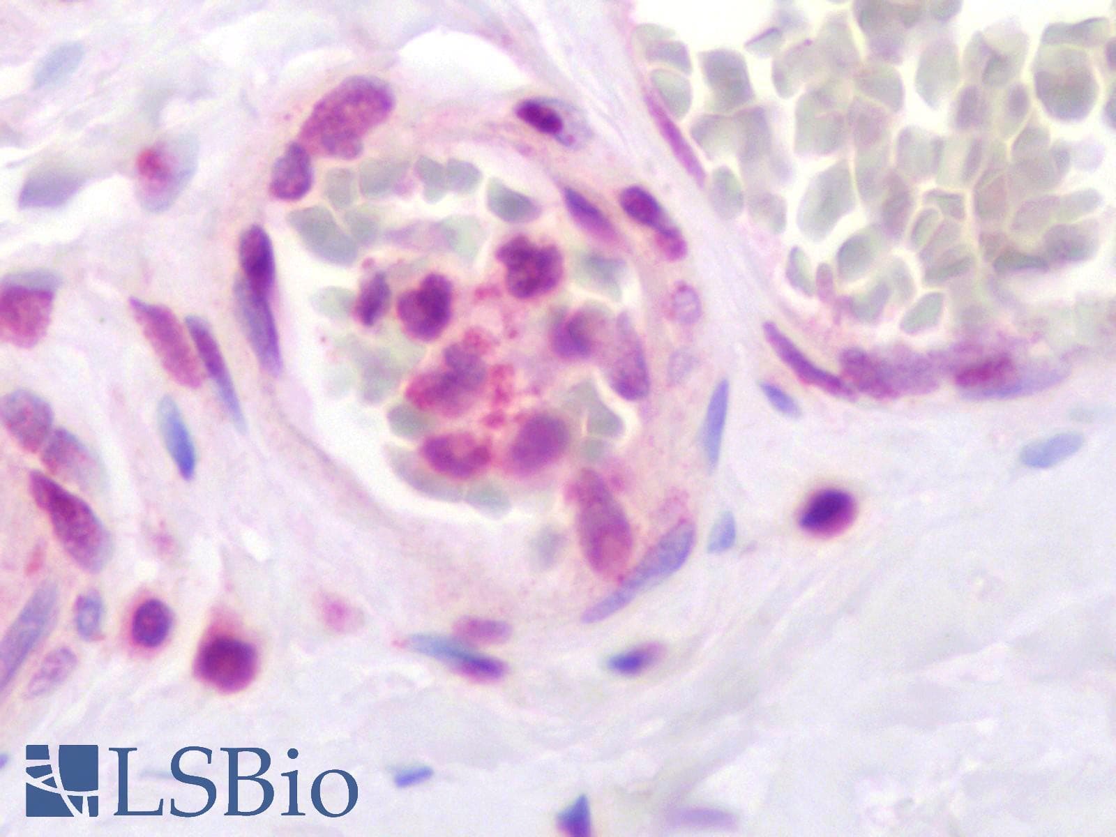 PathPlus™ Polyclonal Rabbit anti-Human CXCR2 Antibody (Extracellular Domain, IHC)