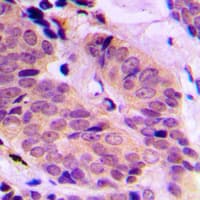 Polyclonal Rabbit anti-Human ABCD4 Antibody (aa126-165, IHC, WB)