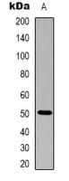 Alliinase Antibody