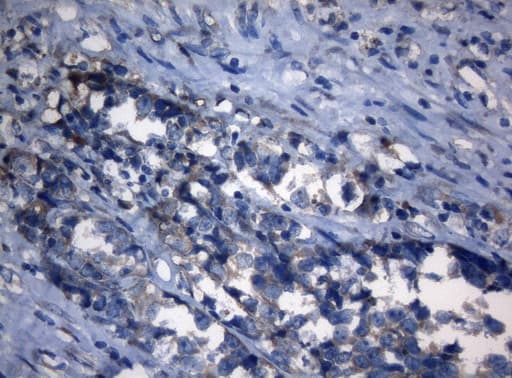 AKT1 Antibody (clone OTI1D12, Carrier-free)