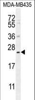 FAM109A Antibody (aa3-31)