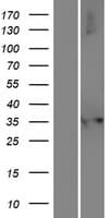 NUDT17 Protein (Over-Expression Lysate Myc-DDK (Flag))
