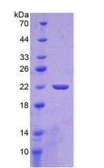 Human SHH / Sonic Hedgehog Protein (Recombinant His-T7)