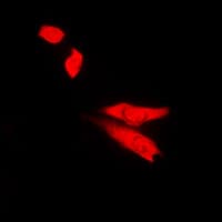 TOP2B / Topoisomerase II Beta Antibody (N-Terminus)
