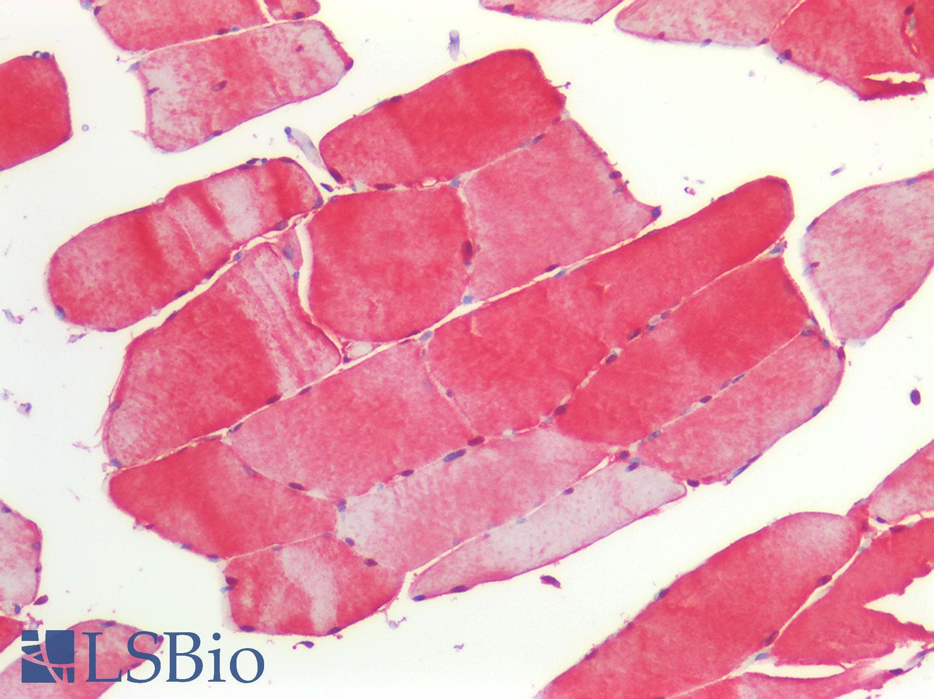 IHC-plus™ Polyclonal Rabbit anti-Human S100A1 / S100-A1 Antibody (N-Terminus, IHC, IF, WB)