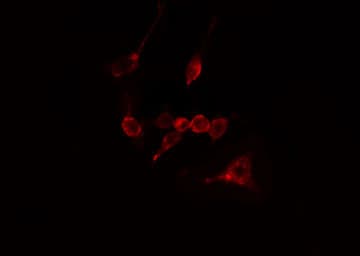 Polyclonal Rabbit anti-Human CAPN10 / Calpain 10 Antibody (IF, WB)