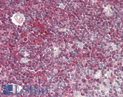 IHC-plus™ CDw218a / IL18R1 Antibody (aa32-329)