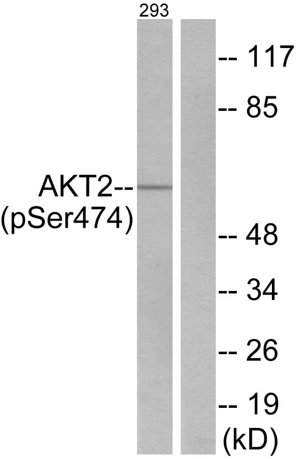 AKT2 Antibody (phospho-Ser474)