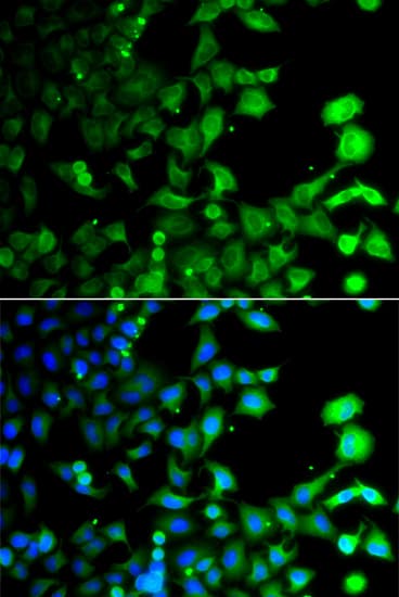 GABARAPL2 / ATG8 Antibody (AP)