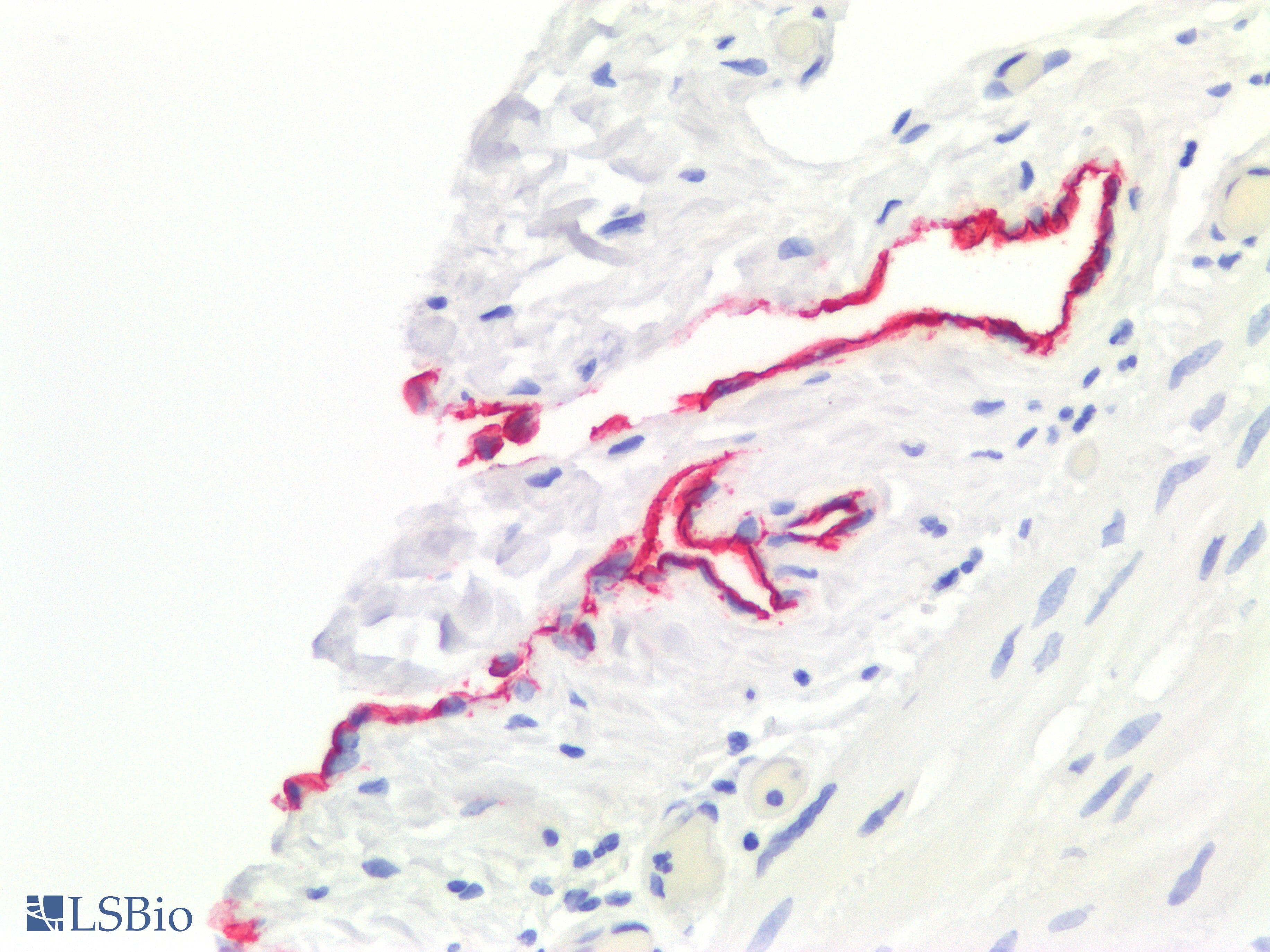 PathPlus™ Mesothelioma Antibody (clone HBME-1)