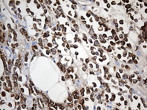 TFF1 / pS2 Antibody (aa25-84, clone OTI7B12)