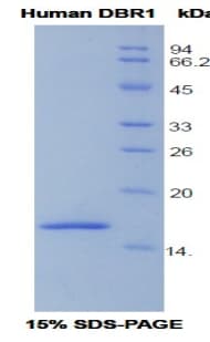 Human DBR1 Protein (Recombinant His)