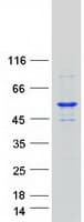 Human SPTLC1 / HSN1 Protein (Recombinant Myc-DDK (Flag))