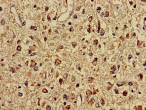 Polyclonal Rabbit anti-Human IMMT / Mitofilin Antibody (IHC, IF, WB)