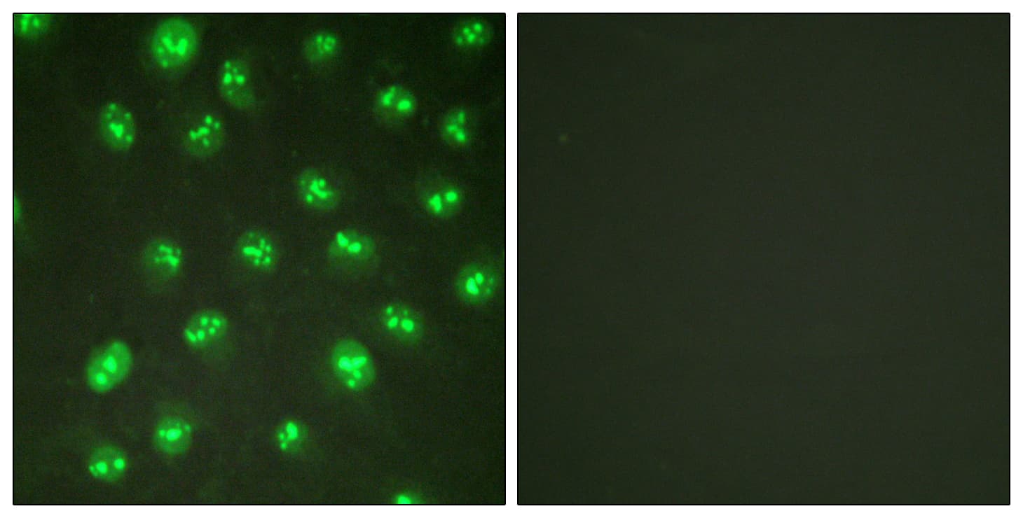 Polyclonal Rabbit anti-Human CDKN1C / p57 Kip2 Antibody (aa267-316, IF, WB)