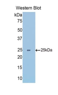 SLIT1 Antibody (aa3-211)