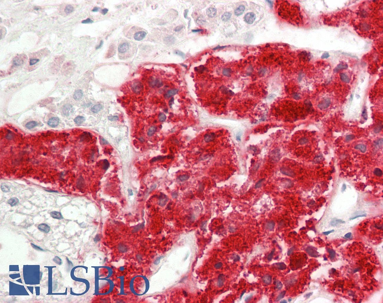 Polyclonal Rabbit anti-Human RHEB Antibody (aa107-156, IHC, WB)
