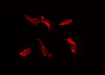 IL20RB Antibody