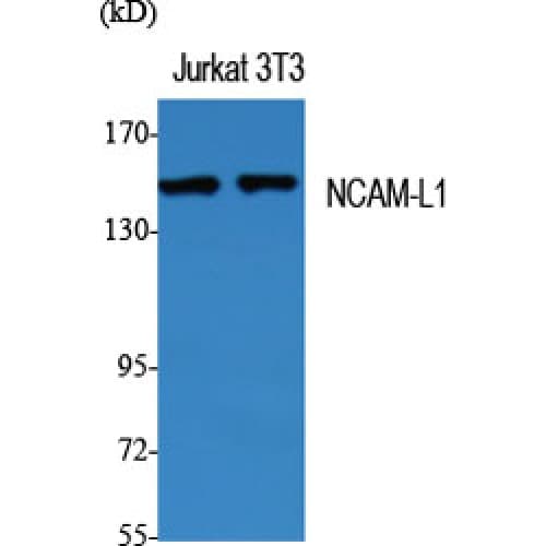 L1CAM Antibody (1120-1200 aa)