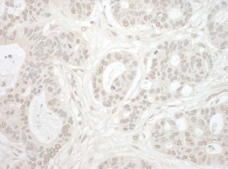 Polyclonal Rabbit anti-Human IPO4 Antibody (aa350-400, IHC)