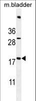 Polyclonal Rabbit anti-Human SDHAF3 / ACN9 Antibody (aa13-42, IHC, WB)