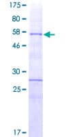Human HOXA9 Protein (Recombinant GST)