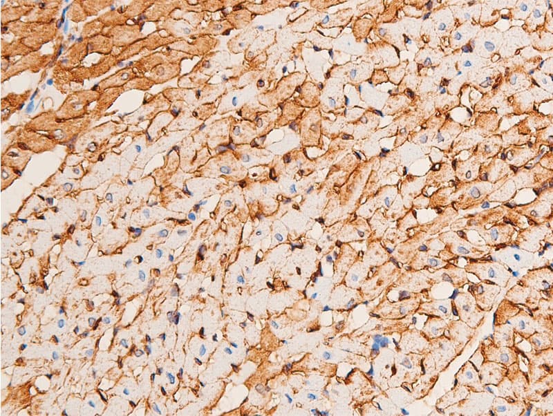 Polyclonal Rabbit anti-Human CHEK1 / CHK1 Antibody (phospho-Ser296, IHC, IF, WB)