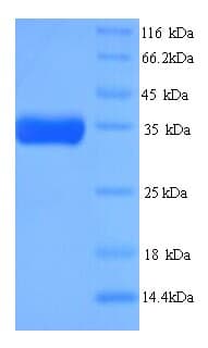 C. elegans R107.2 Protein (Recombinant His)