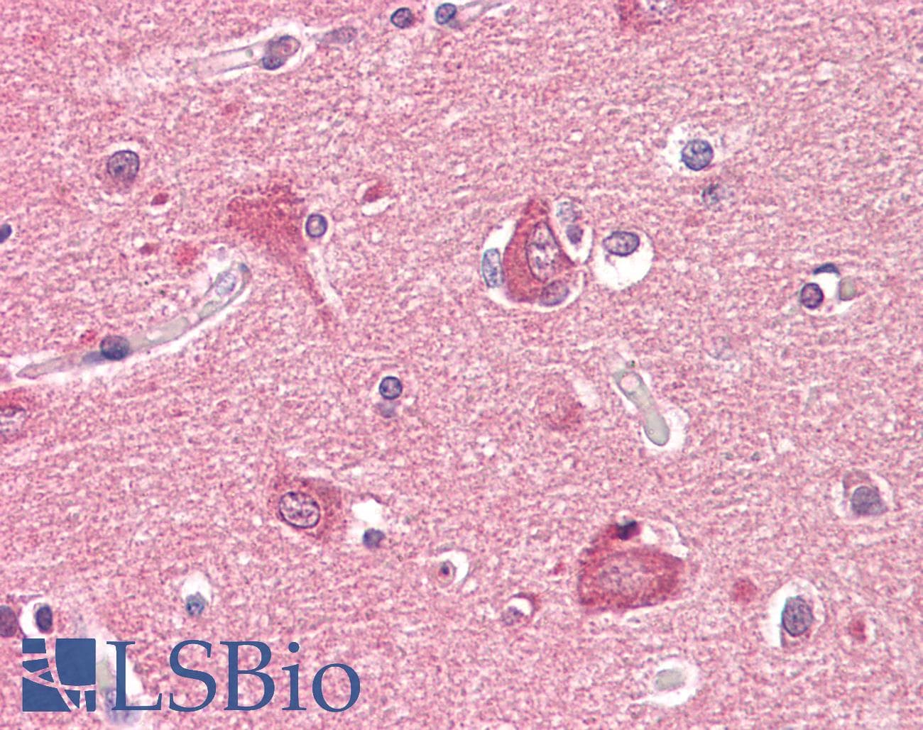 IHC-plus™ Polyclonal Rabbit anti-Human PRKAR2B Antibody (aa79-128, IHC, WB)