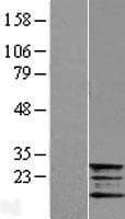 FXN / Frataxin Protein (Over-Expression Lysate Myc-DDK (Flag))