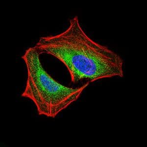 Monoclonal Mouse anti-Human PIK3R1 / p85 Alpha Antibody (clone 6G10, Amino Acid: 159-388, IHC, IF, WB)