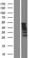 ER81 / ETV1 Protein (Over-Expression Lysate Myc-DDK (Flag))
