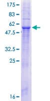 Human MTCH2 Protein (Recombinant GST)