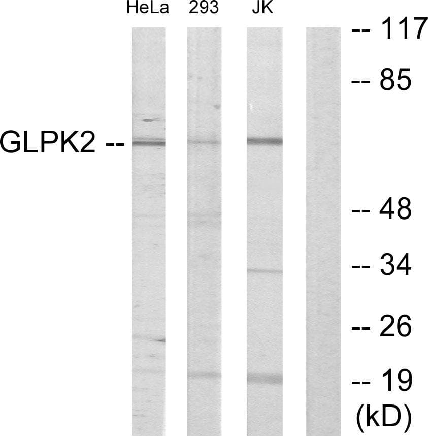 Polyclonal Rabbit anti-Human GK2 / Glycerol Kinase 2 Antibody (WB)