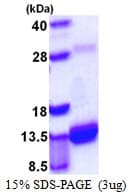 Mouse S100A4 / FSP1 Protein (Recombinant His)