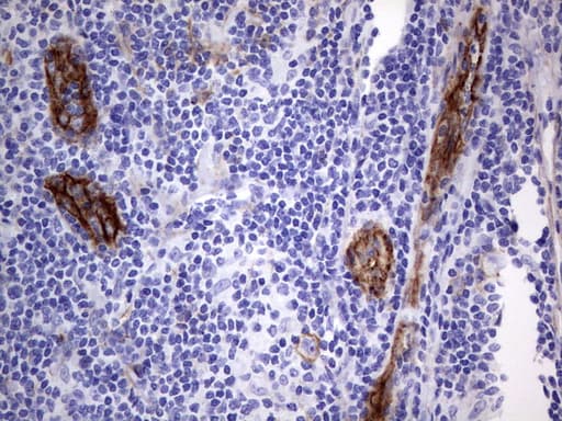 MCAM / CD146 Antibody (clone UMAB155)