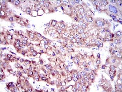 SLC27A5 / BACS Antibody (aa508-570, clone 9C4D1)