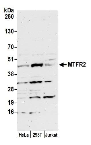 FAM54A / DUFD1 Antibody (aa335-385)