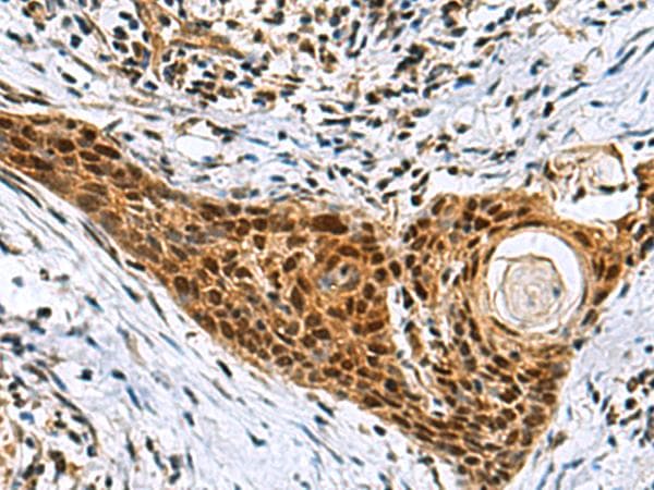NABP1 / OBFC2A Antibody