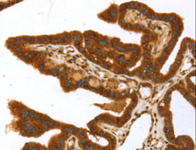 TP53I11 / PIG11 Antibody