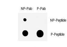 CHEK1 / CHK1 Antibody (phospho-Ser317)