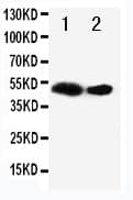 Polyclonal Rabbit anti-Human FLT3LG / Flt3 Ligand Antibody (aa206-220, WB)