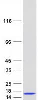 Human B2M / Beta 2 Microglobulin Protein (Recombinant Myc-DDK (Flag))