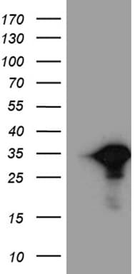 MYL6B Antibody (clone OTI7F10)