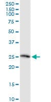 IHC-plus™ TSG / TWSG1 Antibody (clone 2F3)