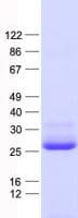 Human RAP1B Protein (Recombinant His, N-Terminal)