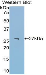 PKM / Pyruvate Kinase, Muscle Antibody (aa324-531)