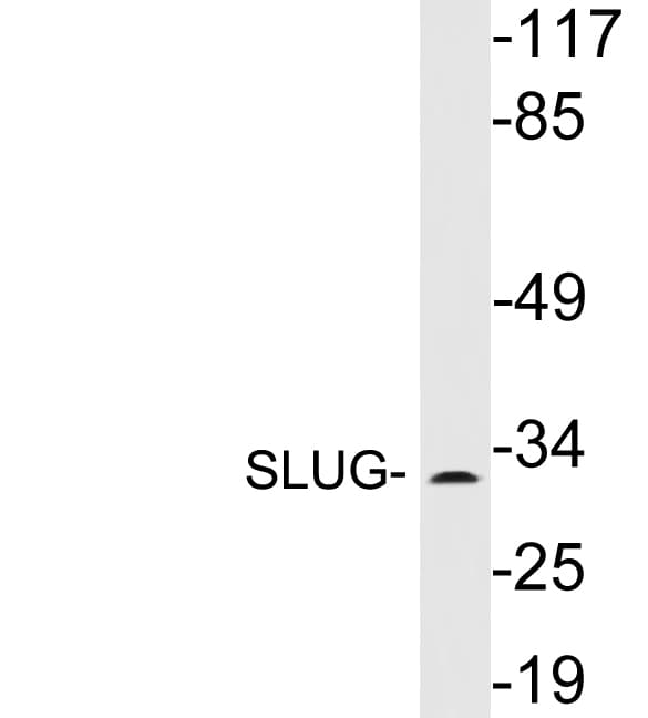SNAI2 / SLUG Antibody (aa21-70)